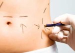 cirurgia-plastica-hortolandia-1409516083