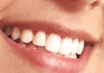 implantes-dentarios-hortolandia-1409577541
