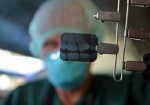 radiografia-odontologia-hortolandia-1409581041